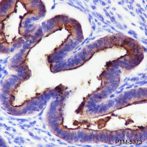 Anti-MUC1 Rabbit mAb