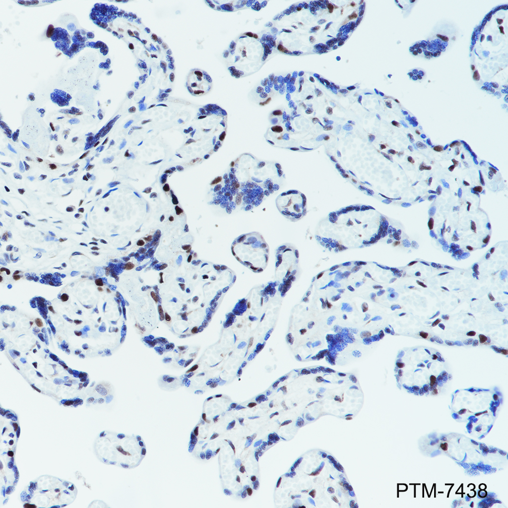 Anti-PWP1 Rabbit mAb