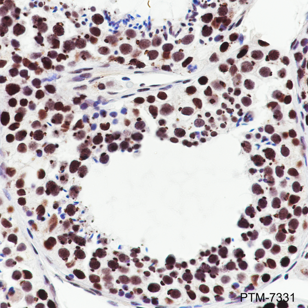 Anti-BRD2 Rabbit mAb