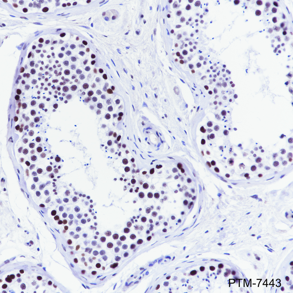 Anti-Rad21 Rabbit mAb