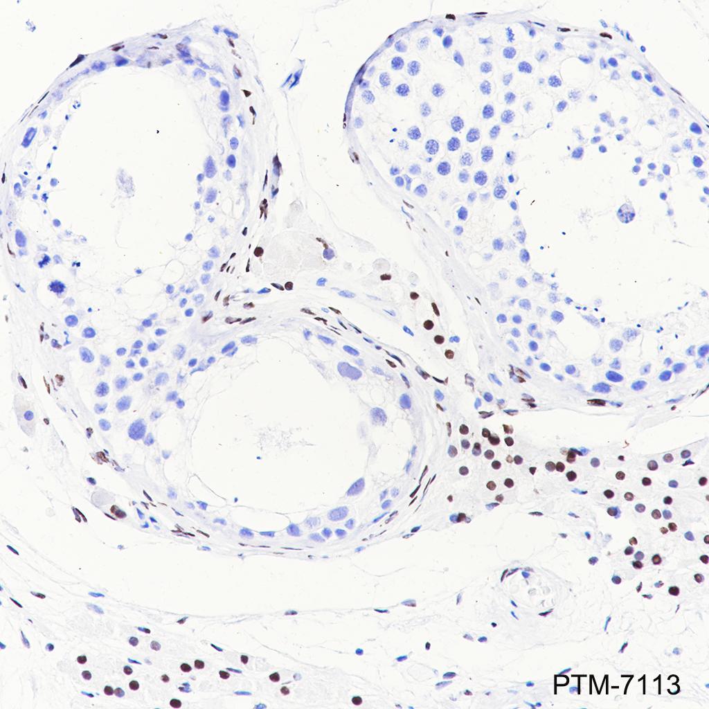 Anti-COUP-TFII Rabbit mAb