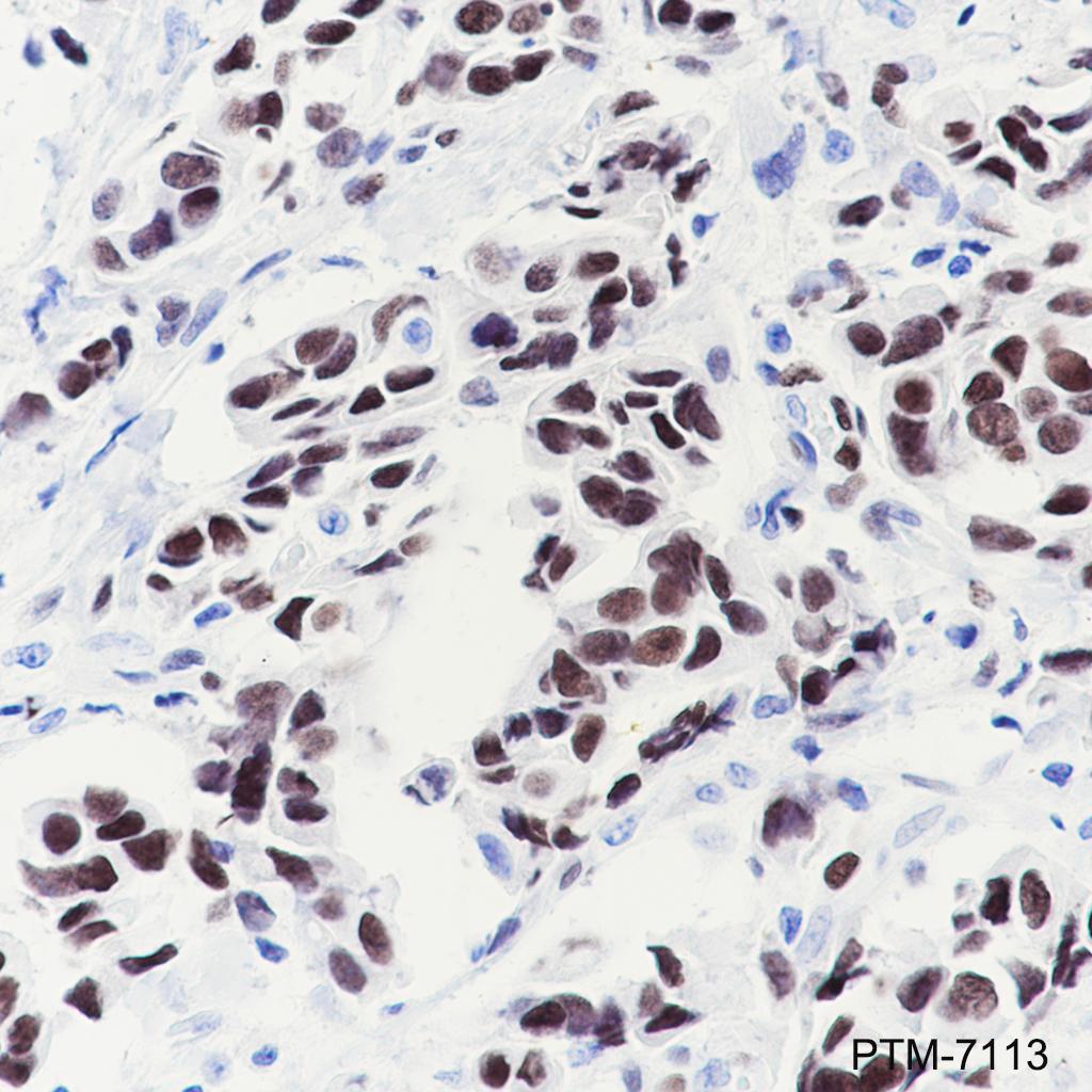 Anti-COUP-TFII Rabbit mAb