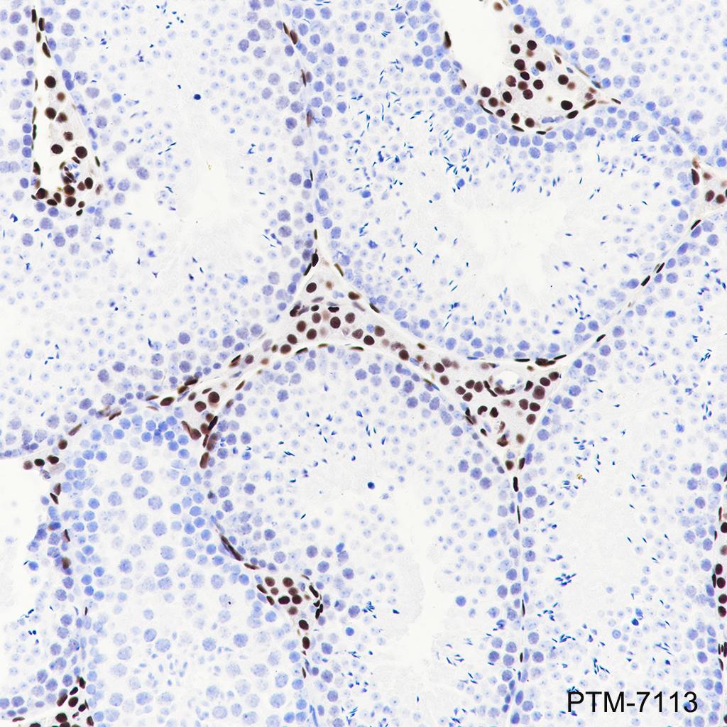 Anti-COUP-TFII Rabbit mAb