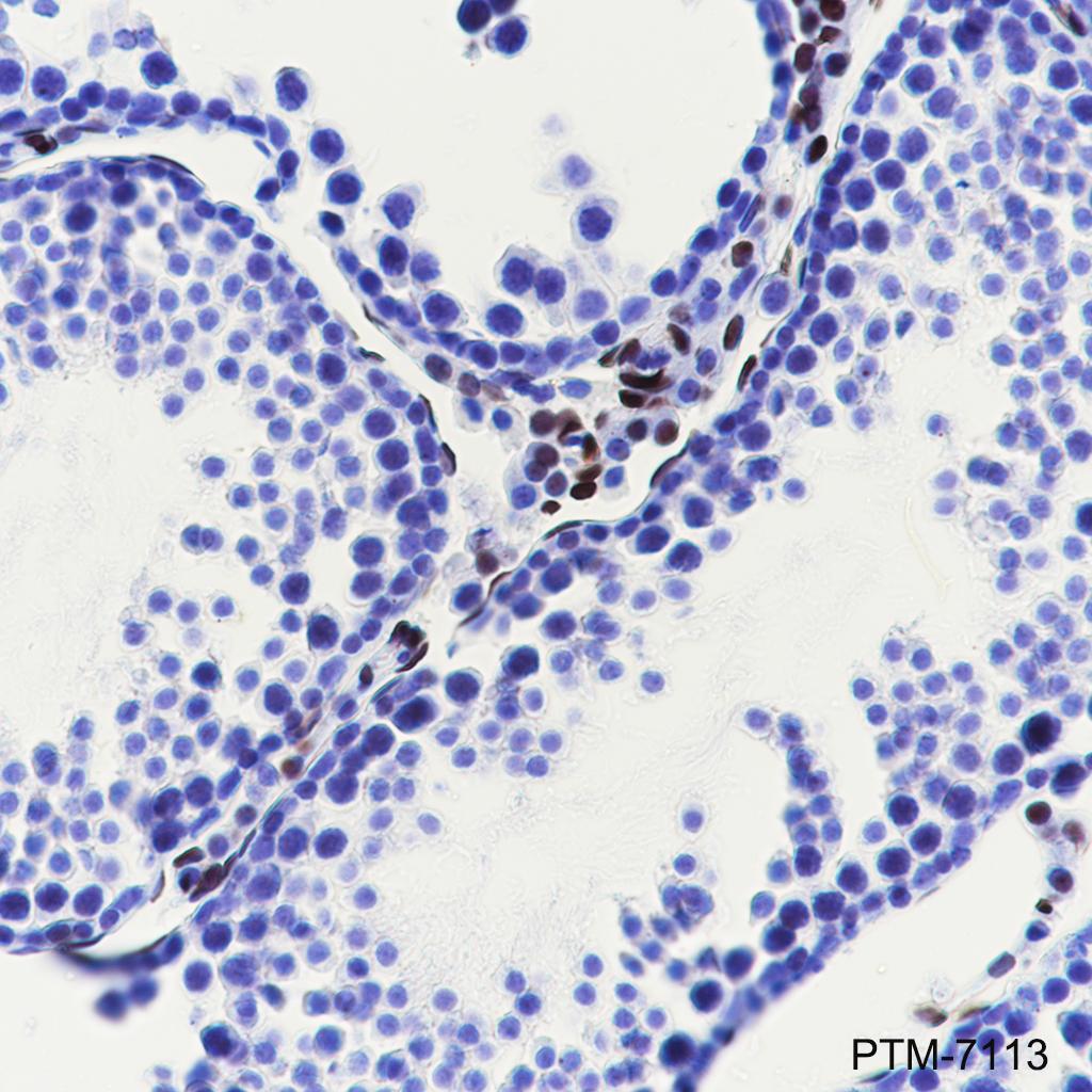 Anti-COUP-TFII Rabbit mAb