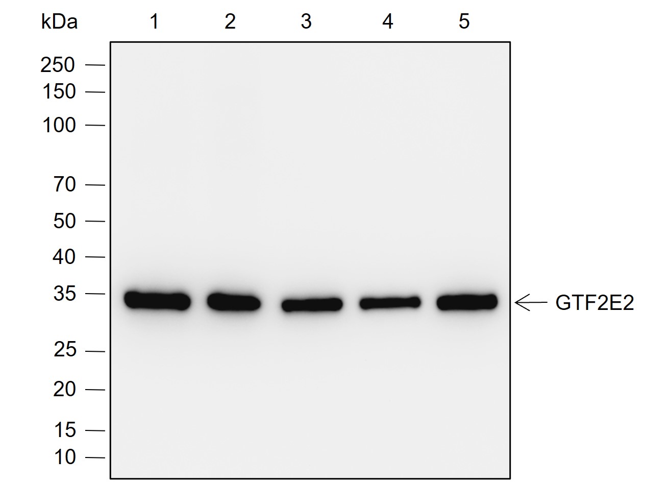 Anti-GTF2E2 Rabbit mAb