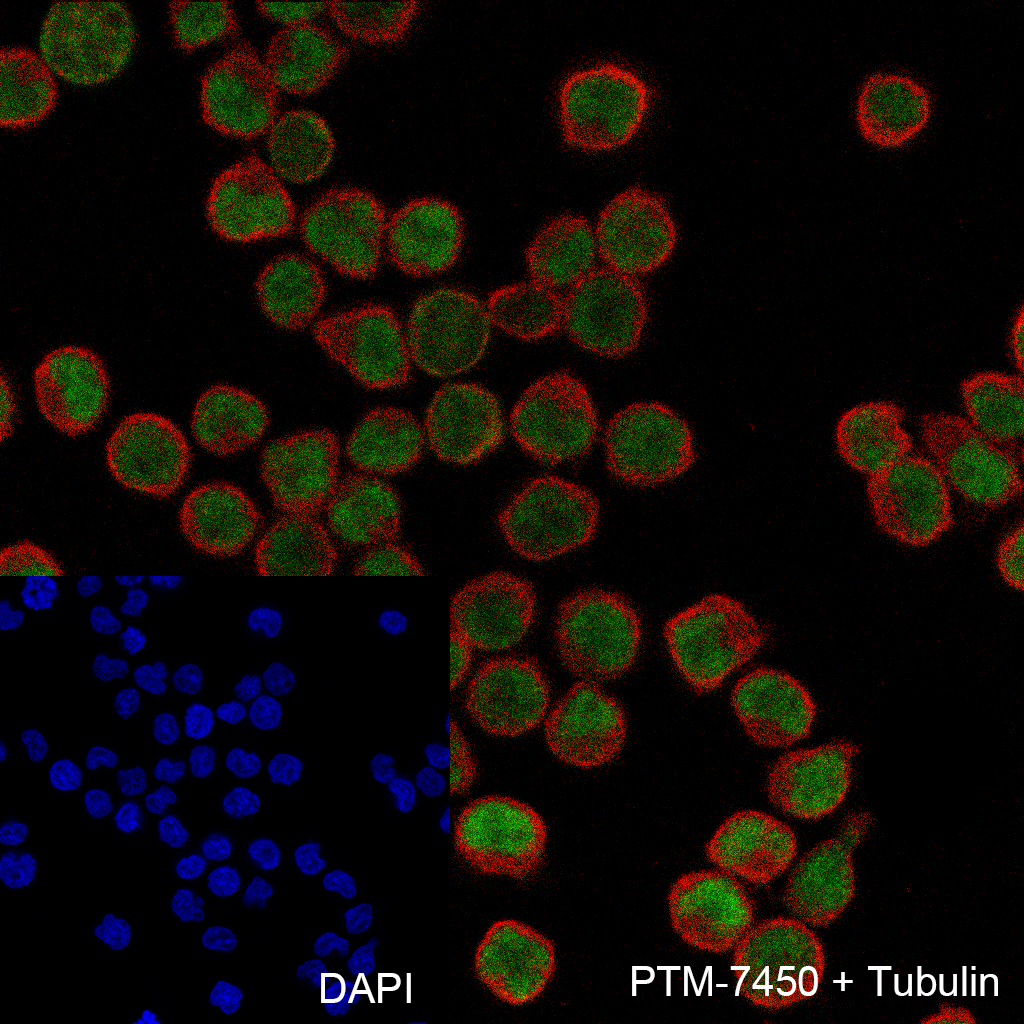 Anti-GTF2E2 Rabbit mAb