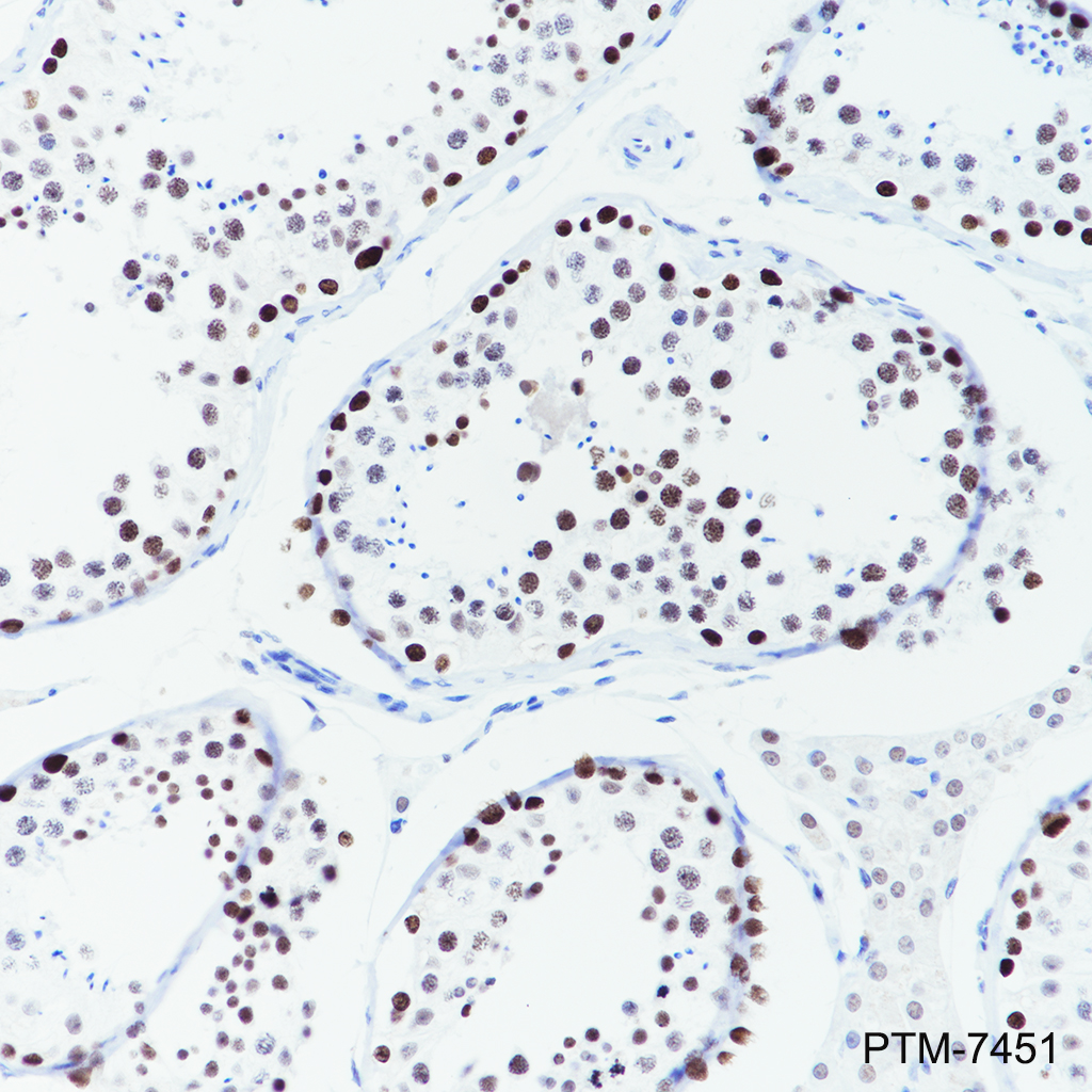 Anti-Cleaved PARP1 p25 Rabbit mAb