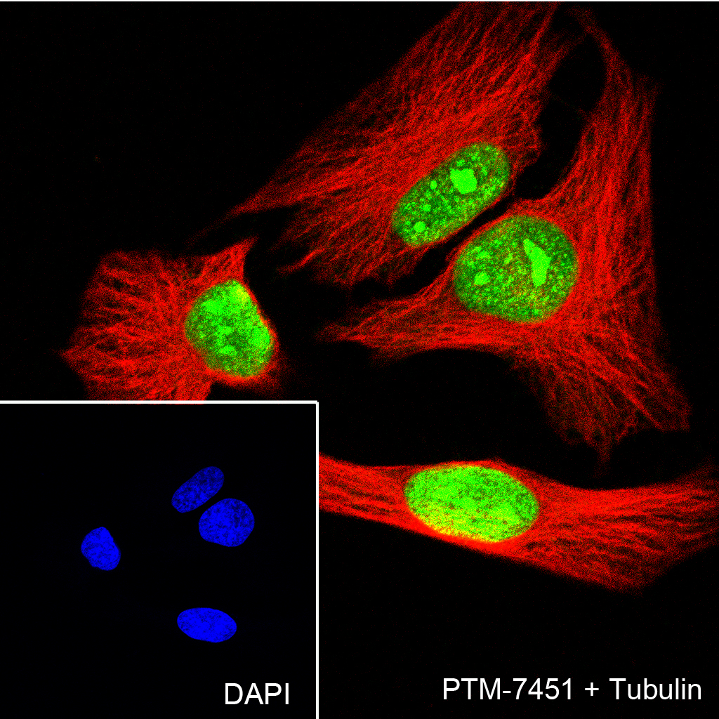 Anti-Cleaved PARP1 p25 Rabbit mAb