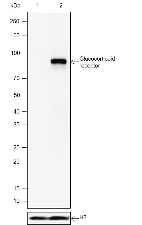 Anti-Glucocorticoid Receptor Rabbit mAb