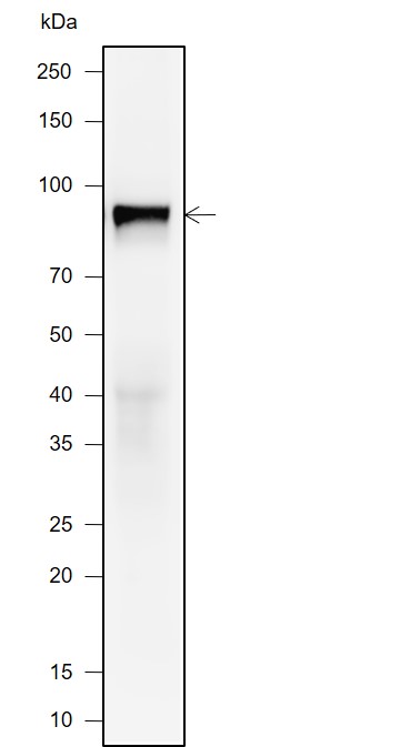 Anti-Glucocorticoid Receptor Rabbit mAb