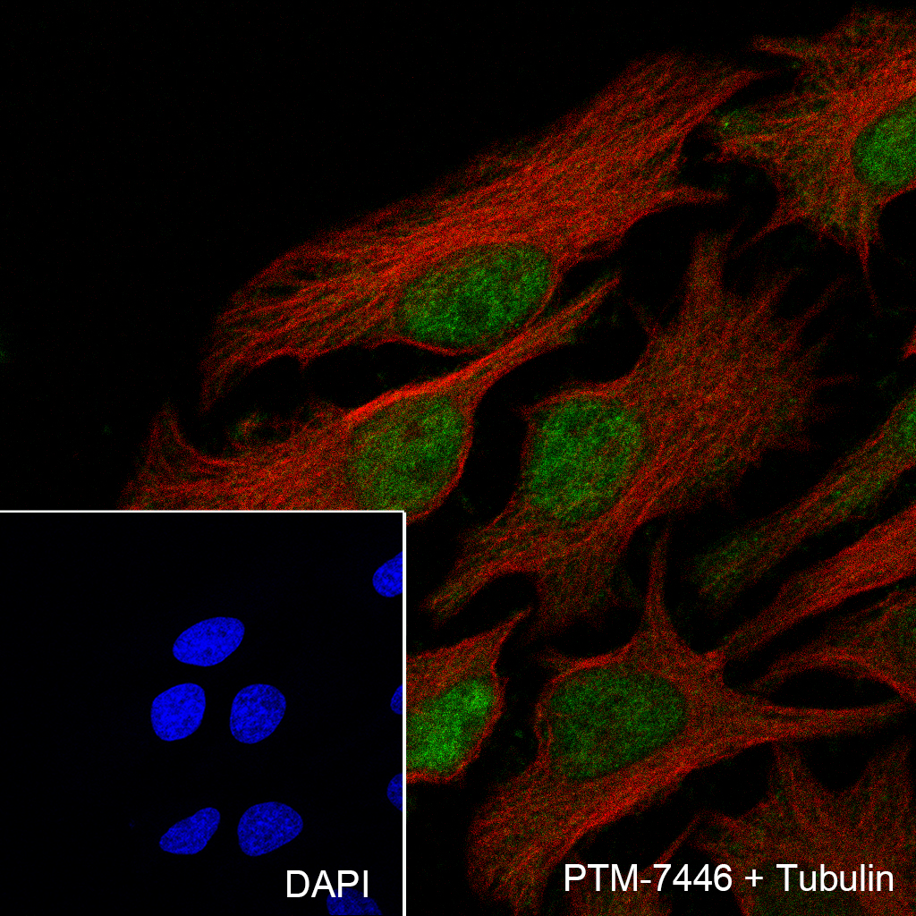 Anti-Glucocorticoid Receptor Rabbit mAb