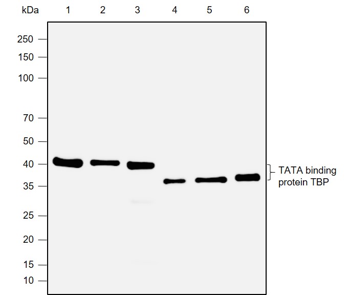 Anti-TBP Rabbit mAb