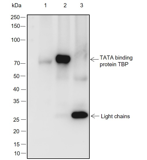 Anti-TBP Rabbit mAb