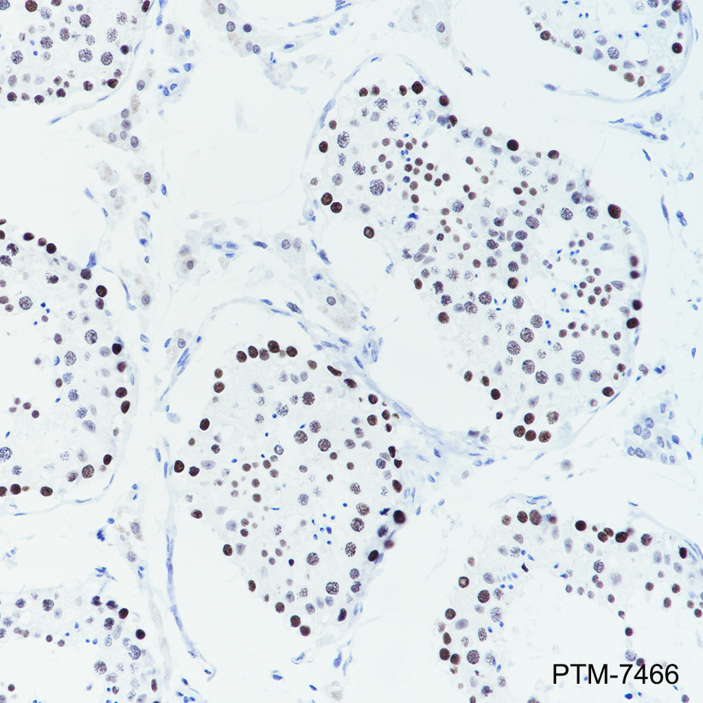 Anti-Cleaved PARP1 p85 Rabbit mAb