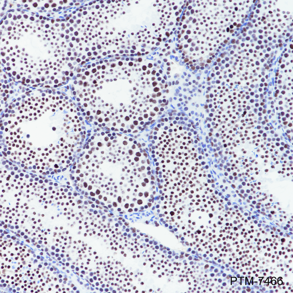 Anti-Cleaved PARP1 p85 Rabbit mAb