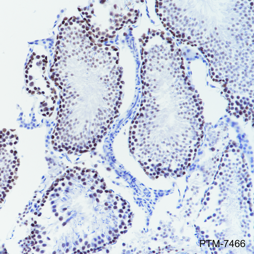 Anti-Cleaved PARP1 p85 Rabbit mAb
