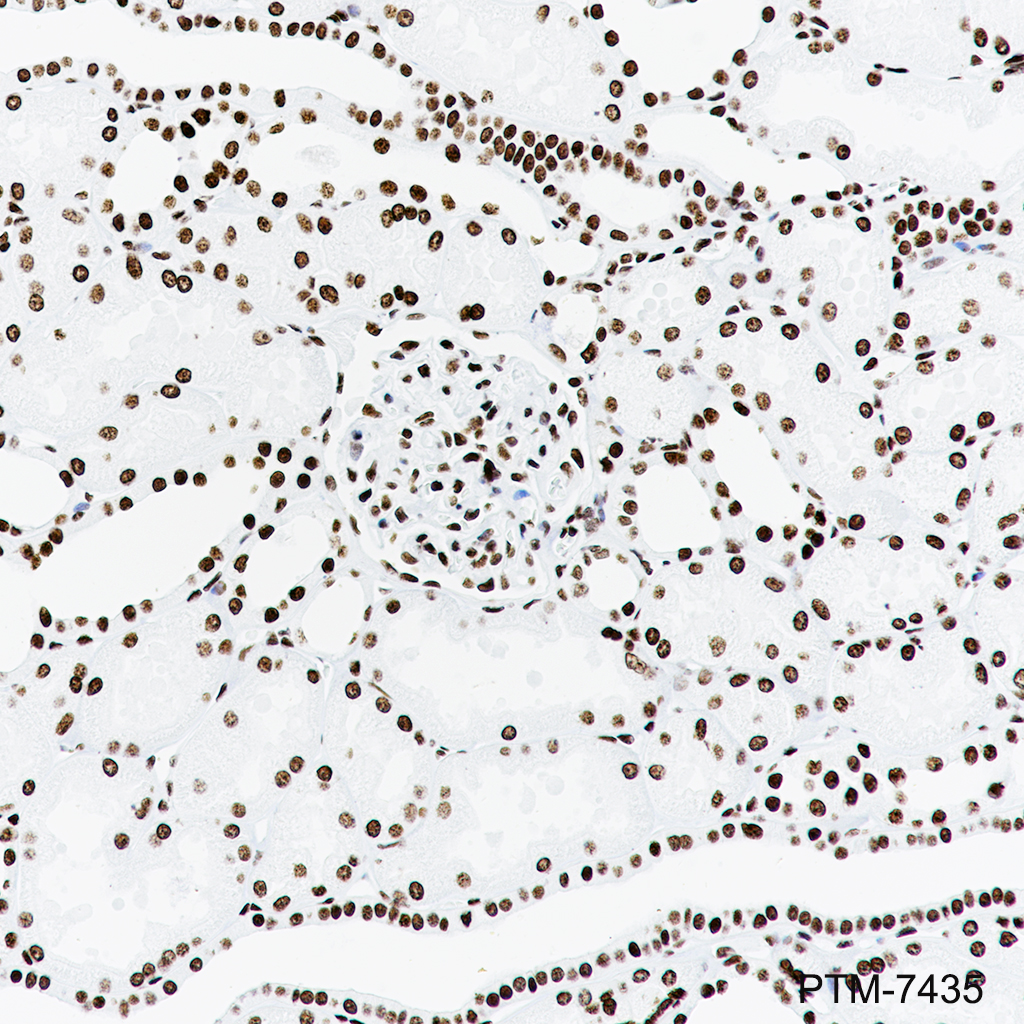 Anti-Mono/Di/Tri-Methyl-Histone H3 (Lys79) Rabbit mAb