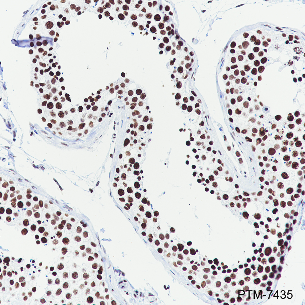 Anti-Mono/Di/Tri-Methyl-Histone H3 (Lys79) Rabbit mAb