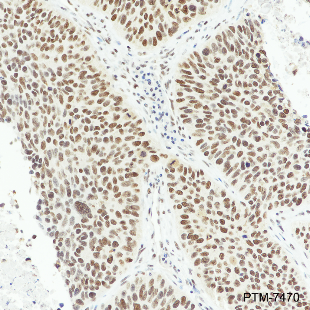 Anti-RBBP7/RBBP4 Rabbit mAb