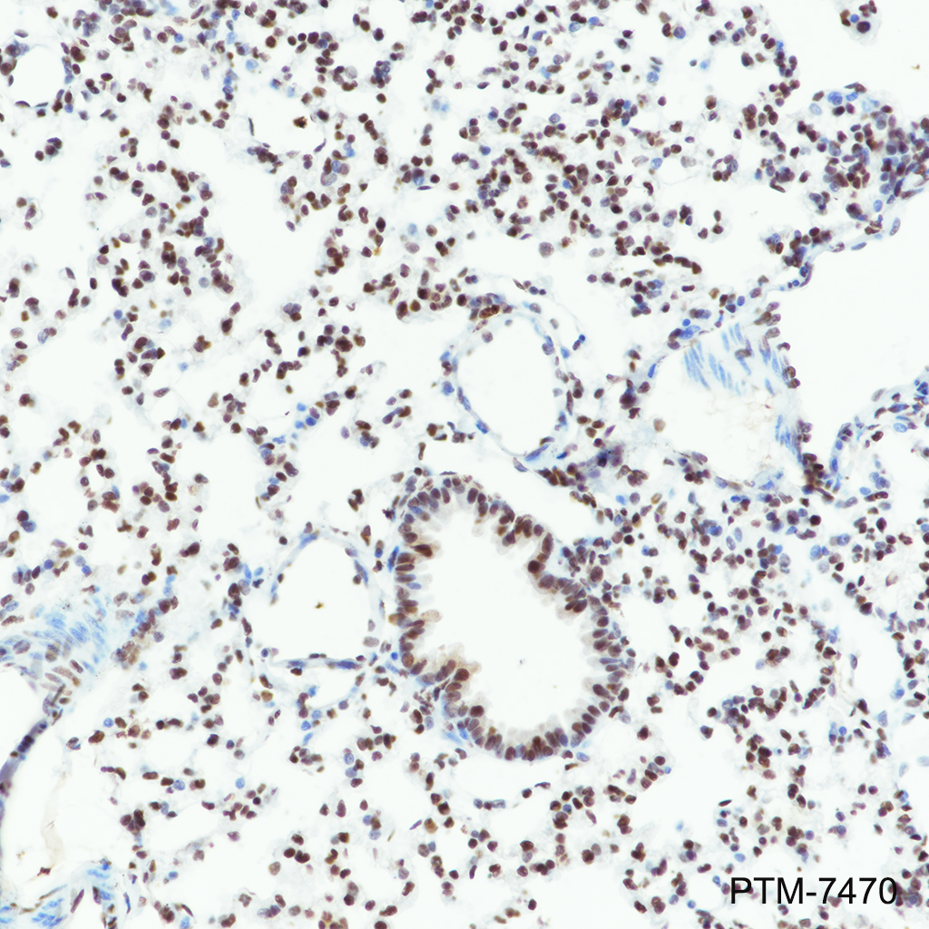 Anti-RBBP7/RBBP4 Rabbit mAb