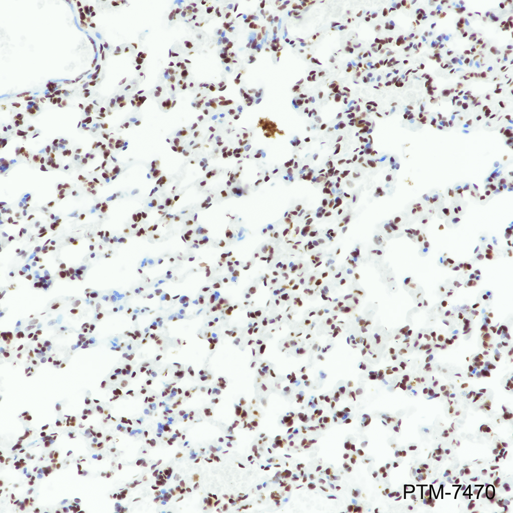 Anti-RBBP7/RBBP4 Rabbit mAb