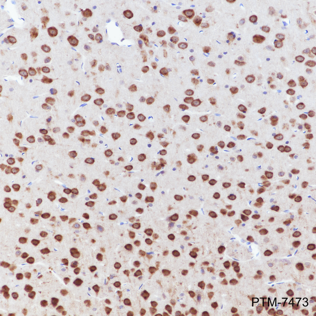 Anti-CSDE1 Rabbit mAb