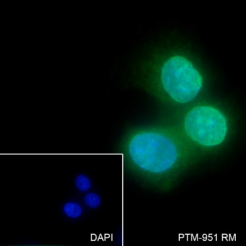 Anti-O-Linked N-Acetylglucosamine Rabbit mAb