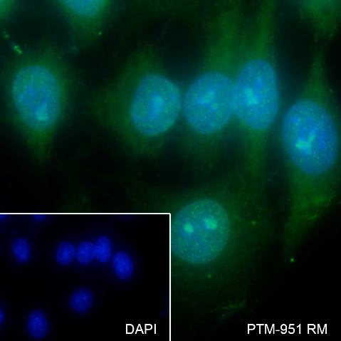 Anti-O-Linked N-Acetylglucosamine Rabbit mAb