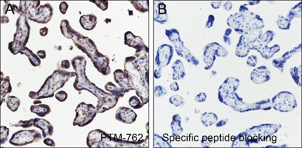 Anti-Benzoyllysine Mouse mAb