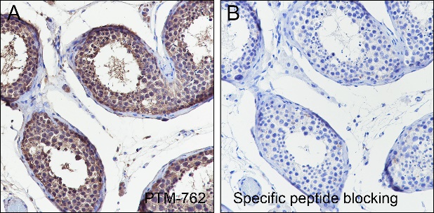 Anti-Benzoyllysine Mouse mAb