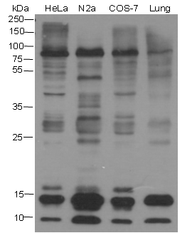 Anti-SUMO-1/2/3 Mouse mAb (N-terminal)
