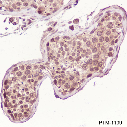 Anti-SUMO-1/2/3 Mouse mAb (N-terminal)