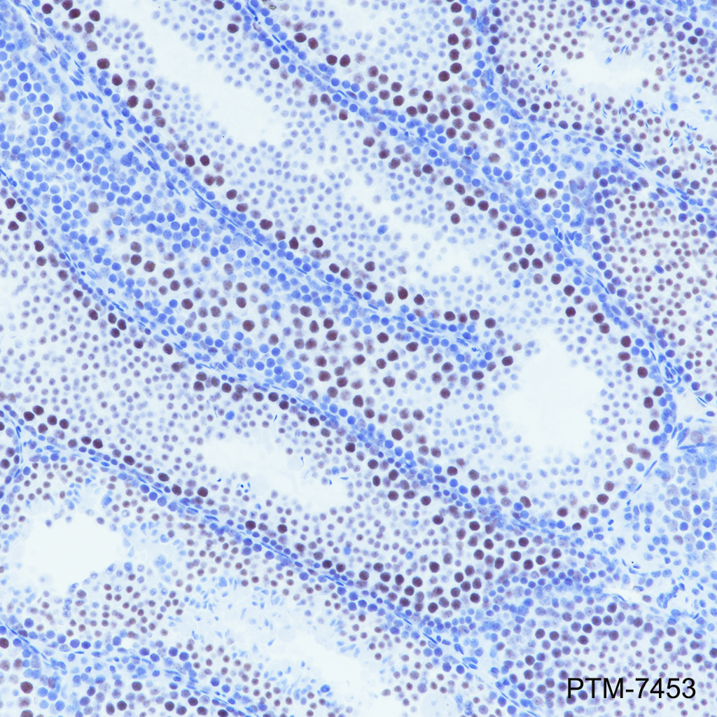 Anti-DGCR8 Rabbit mAb