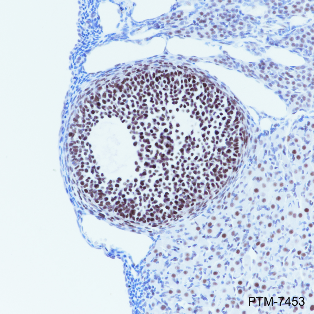 Anti-DGCR8 Rabbit mAb