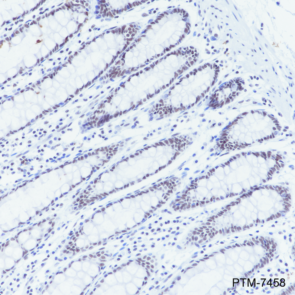 Anti-SIN3A Rabbit mAb
