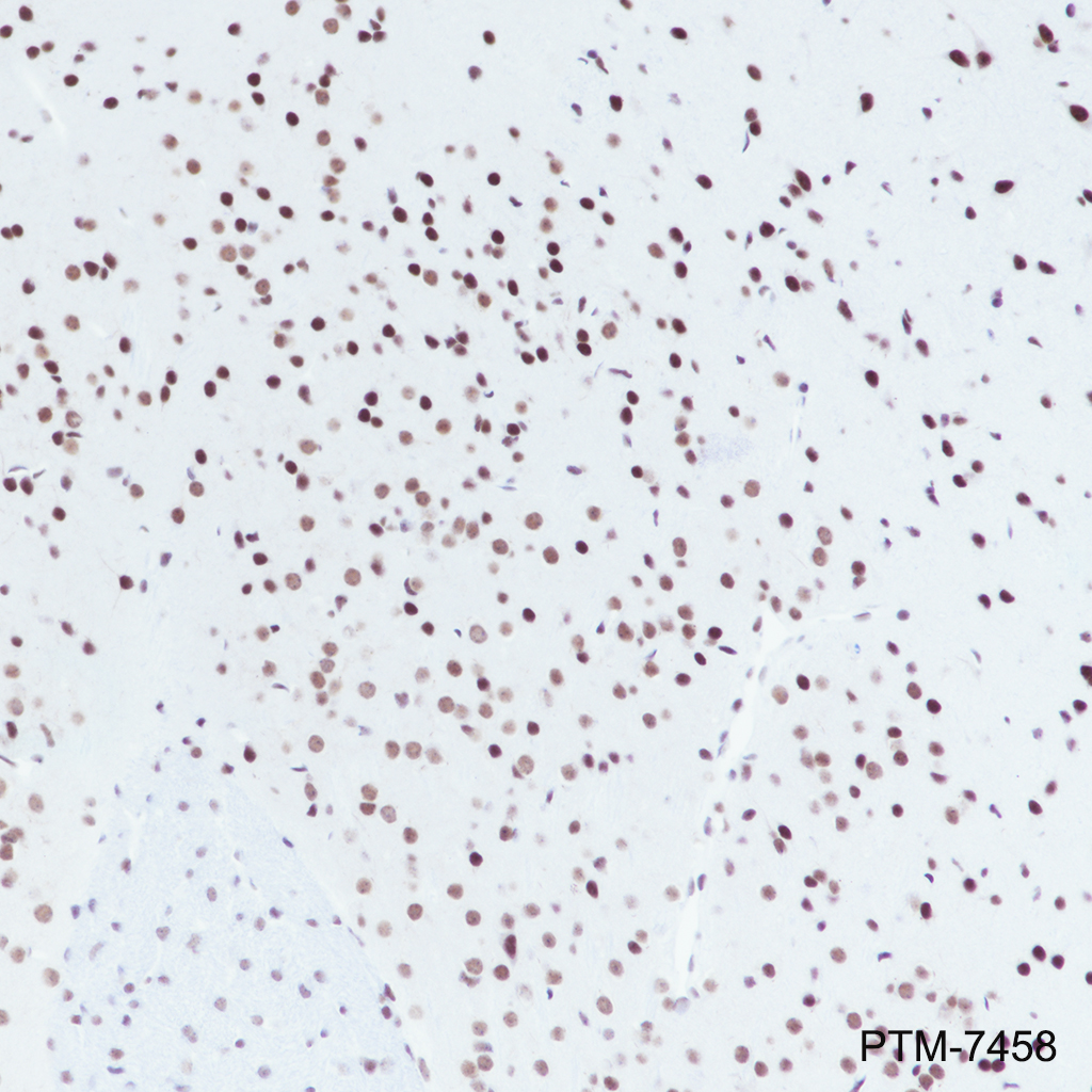 Anti-SIN3A Rabbit mAb