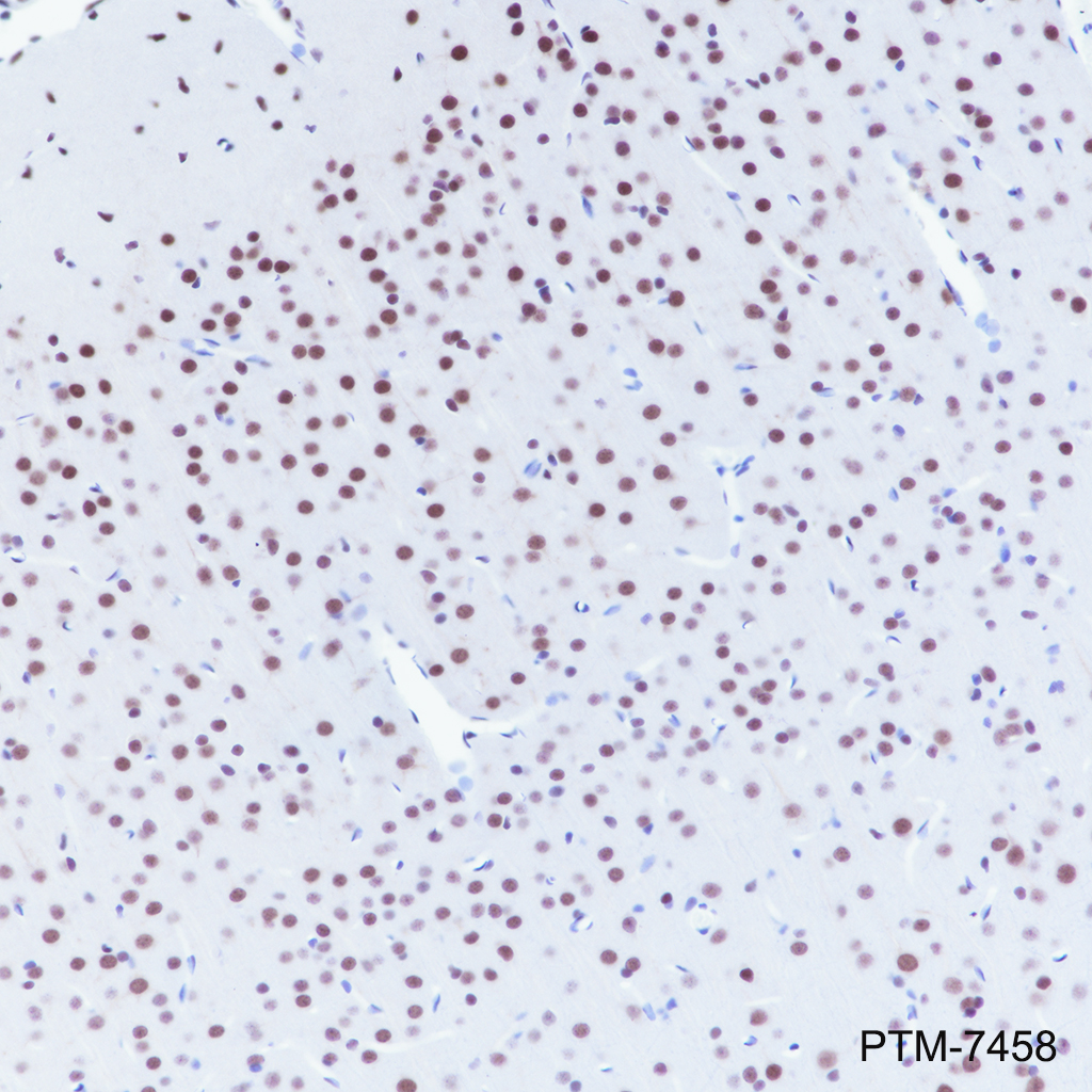 Anti-SIN3A Rabbit mAb