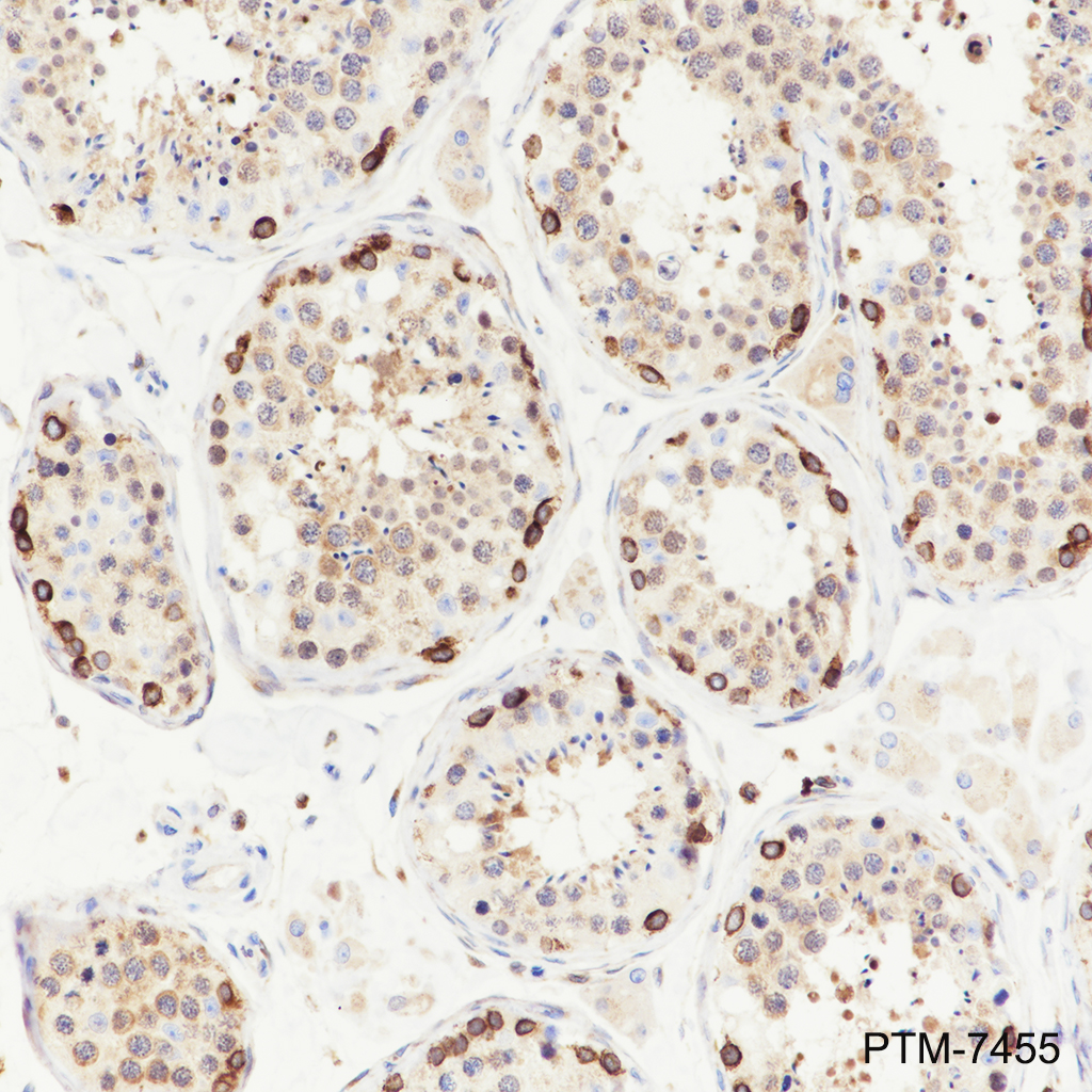 Anti-CTCFL Rabbit mAb