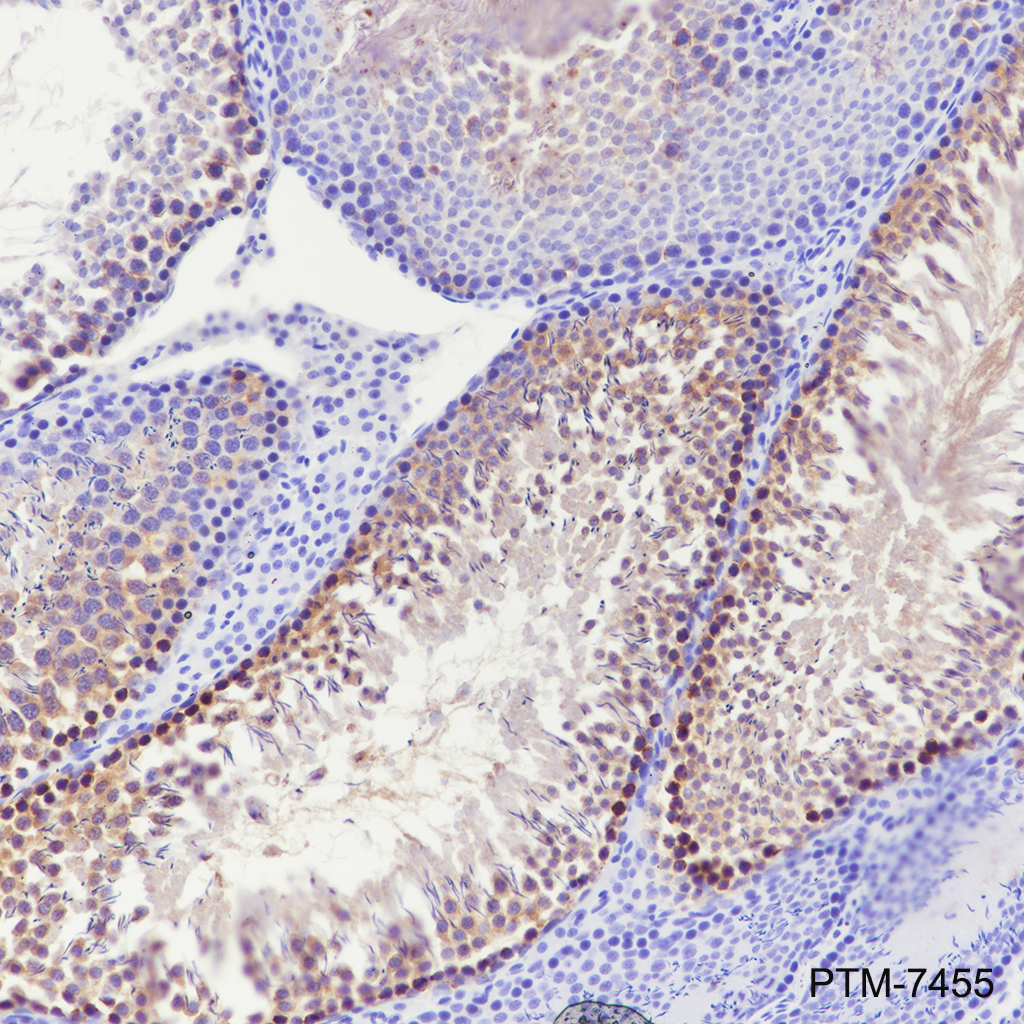 Anti-CTCFL Rabbit mAb