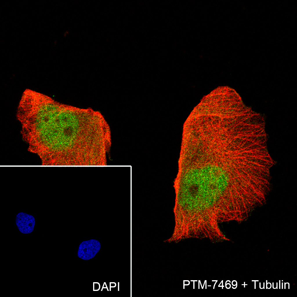 Anti-MCM7 Rabbit mAb