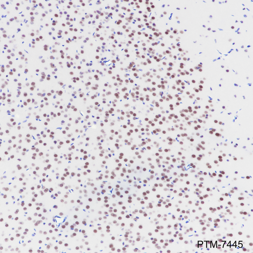 Anti-PBX1 Rabbit mAb
