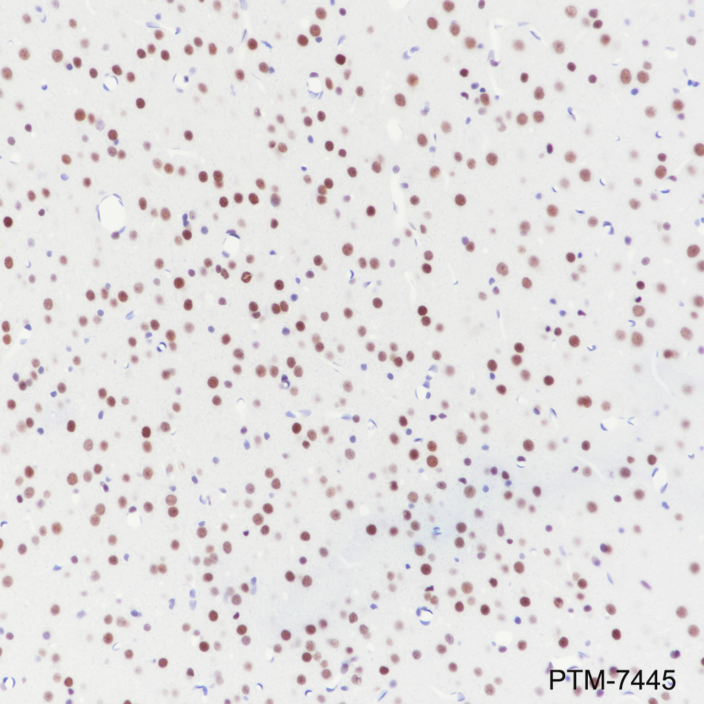 Anti-PBX1 Rabbit mAb