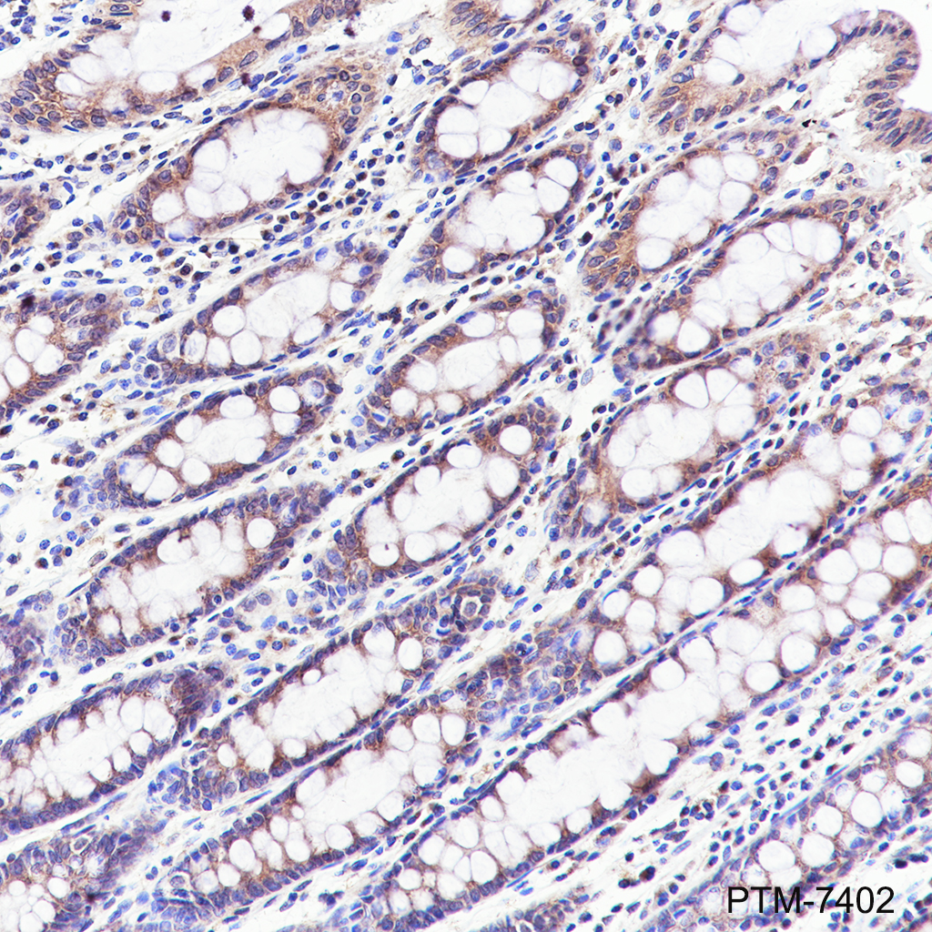 Anti-GOLGA2/GM130 Rabbit mAb