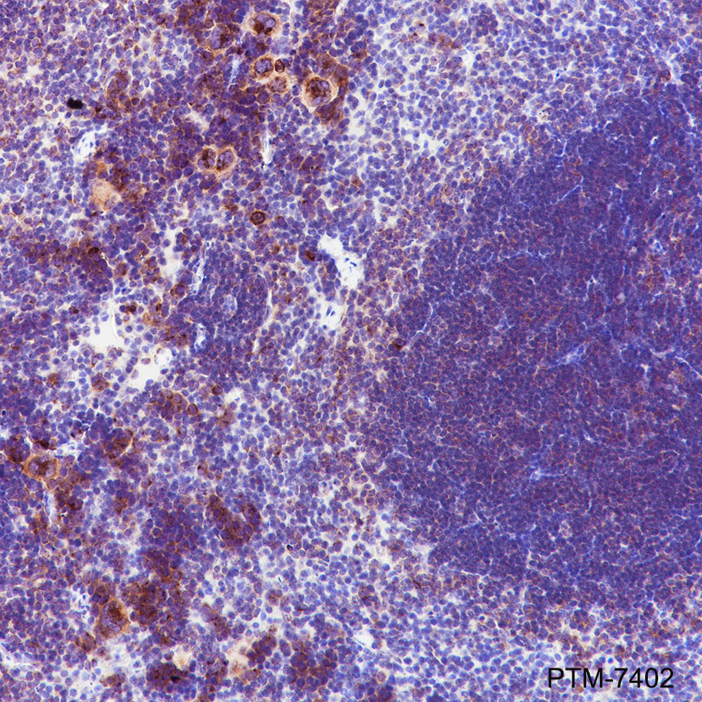 Anti-GOLGA2/GM130 Rabbit mAb