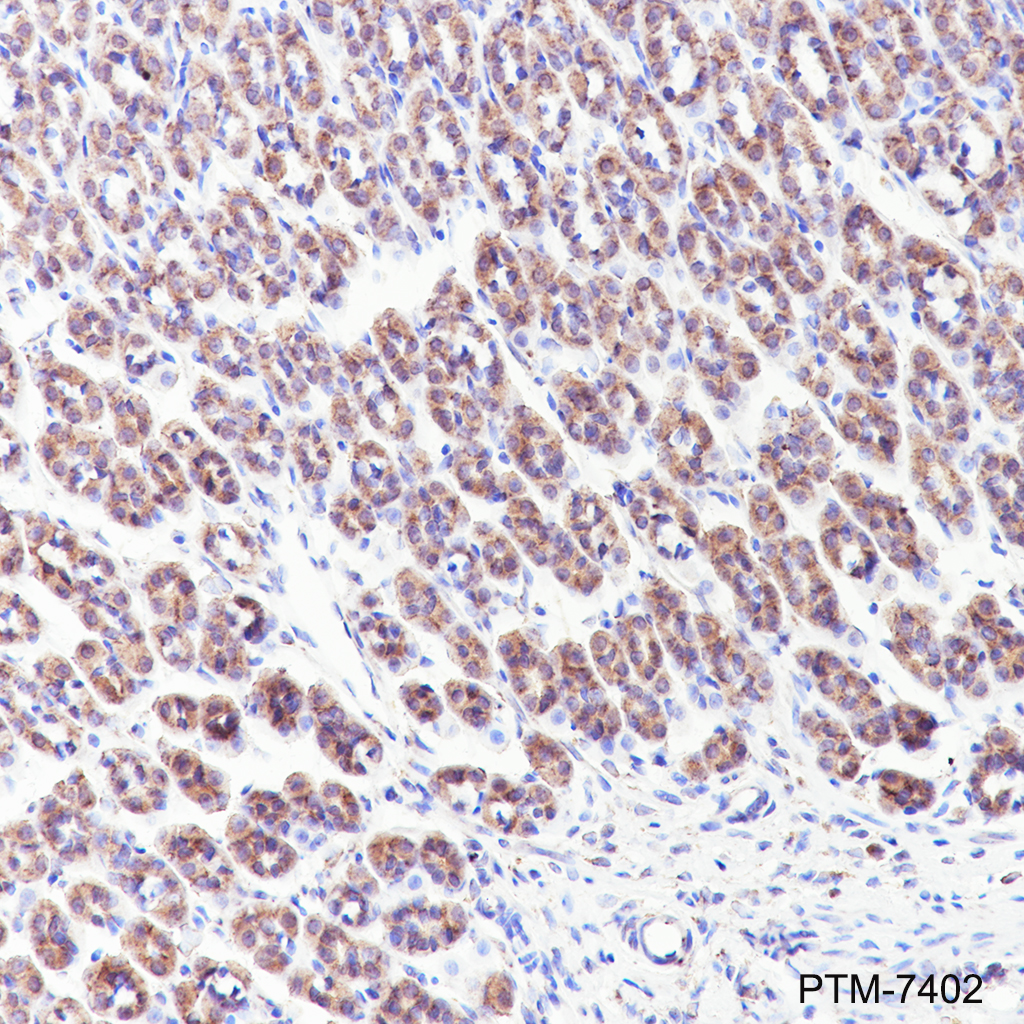 Anti-GOLGA2/GM130 Rabbit mAb