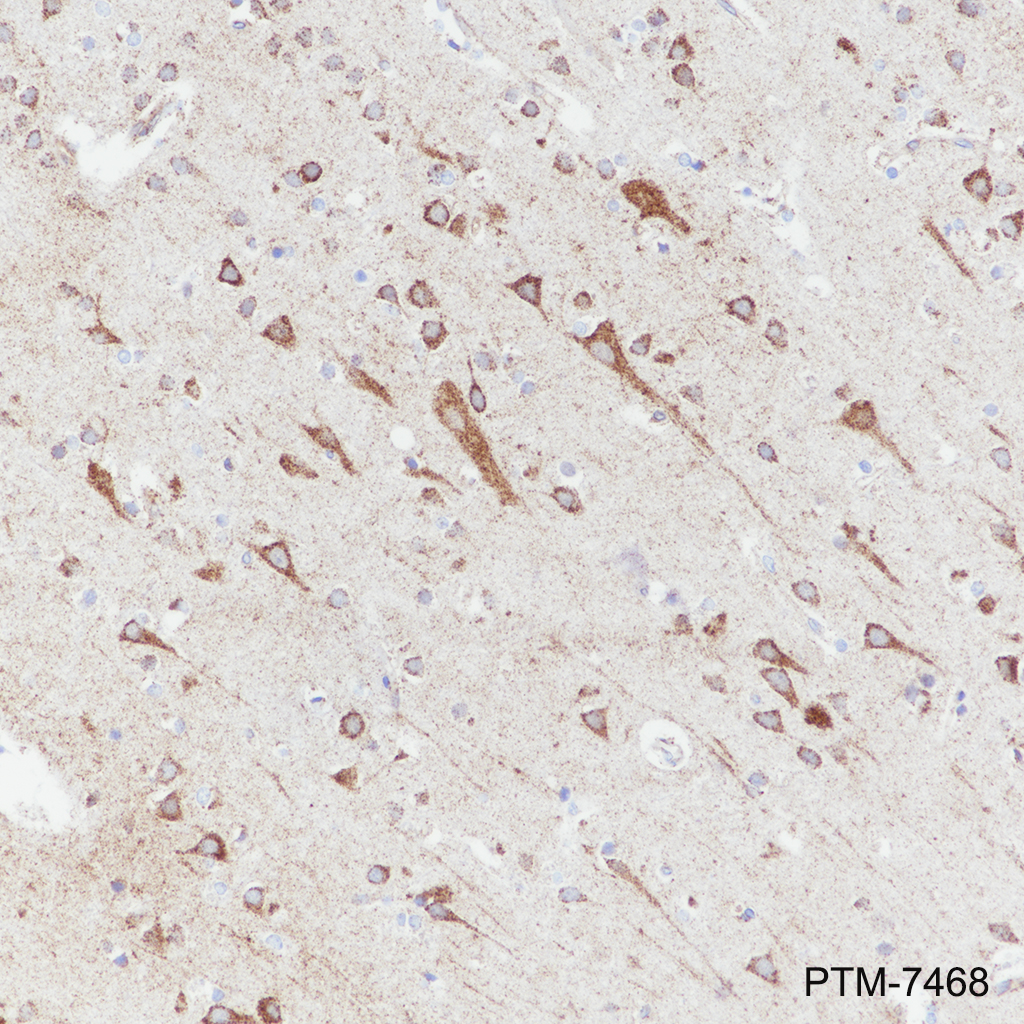 Anti-eIF4A2 Rabbit mAb