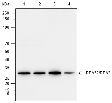 Anti-RPA32/RPA2 Rabbit mAb