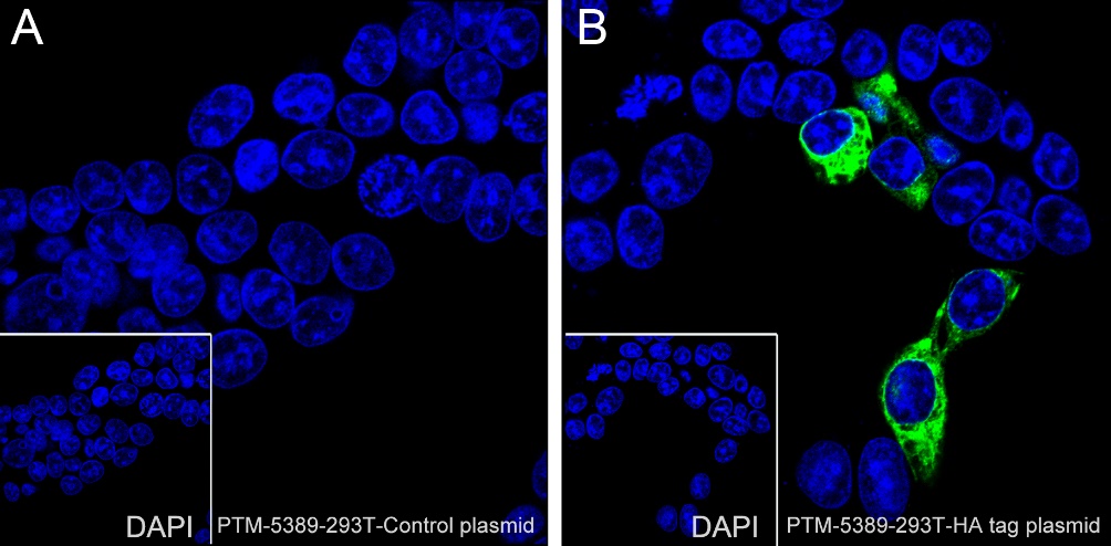 Anti-HA Tag Rabbit mAb