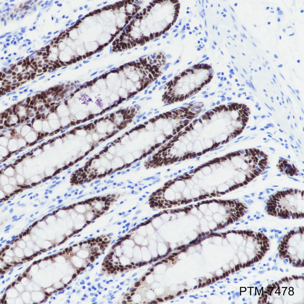 Anti-CDX1 Rabbit mAb