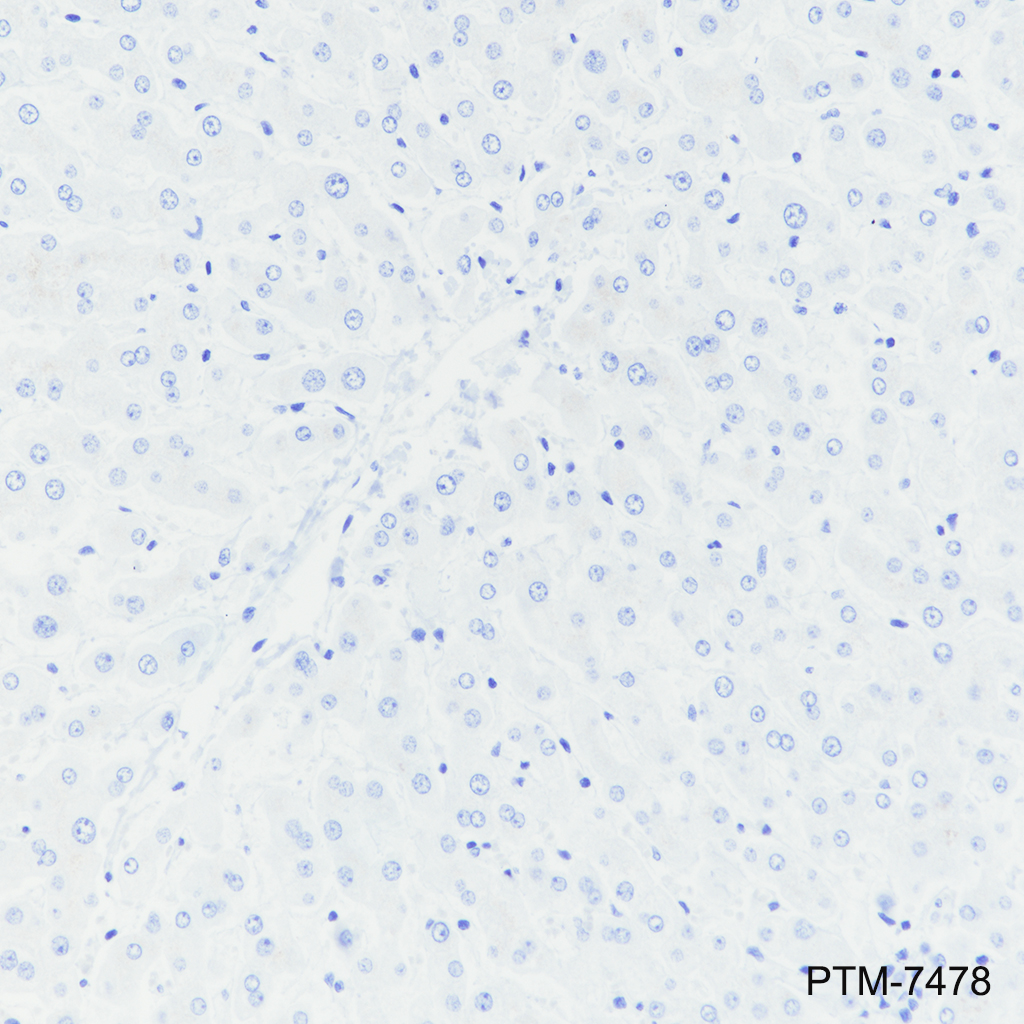Anti-CDX1 Rabbit mAb